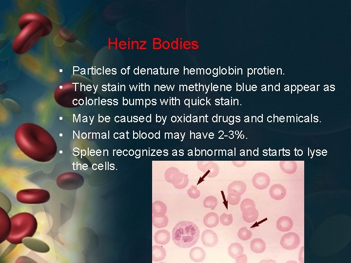 Heinz Bodies • Particles of denature hemoglobin protien. • They stain with new methylene