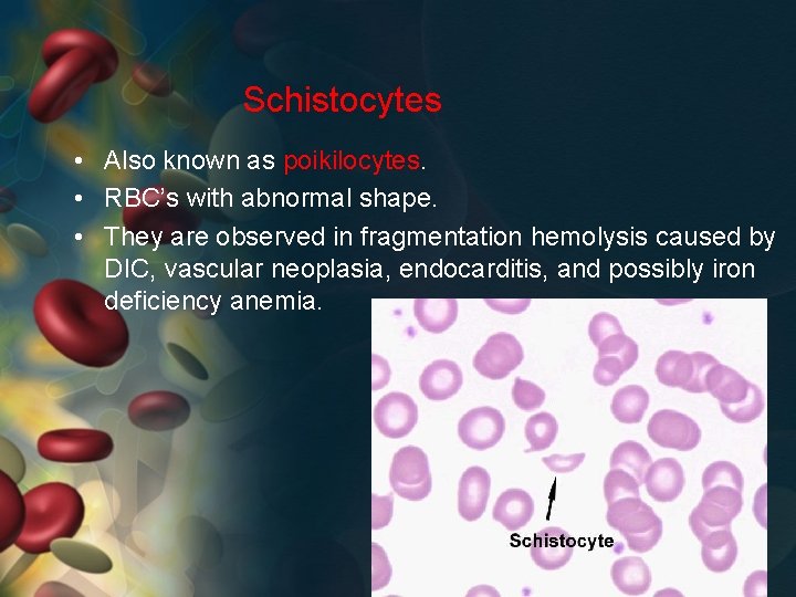 Schistocytes • Also known as poikilocytes. • RBC’s with abnormal shape. • They are