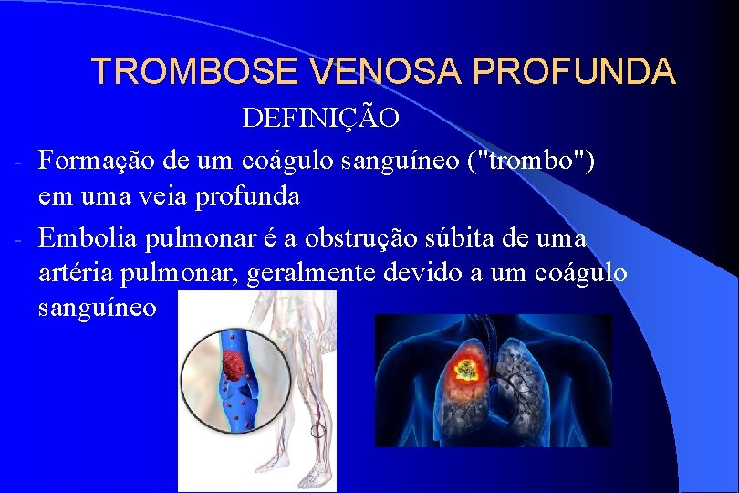TROMBOSE VENOSA PROFUNDA DEFINIÇÃO - Formação de um coágulo sanguíneo ("trombo") em uma veia