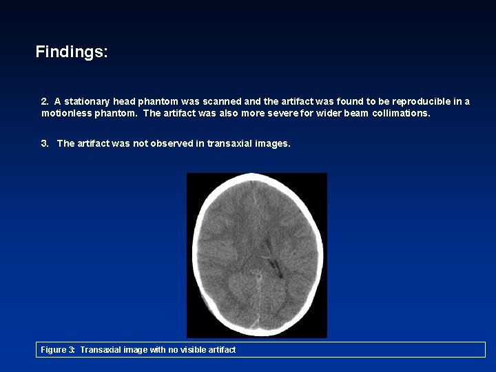 Findings: 2. A stationary head phantom was scanned and the artifact was found to