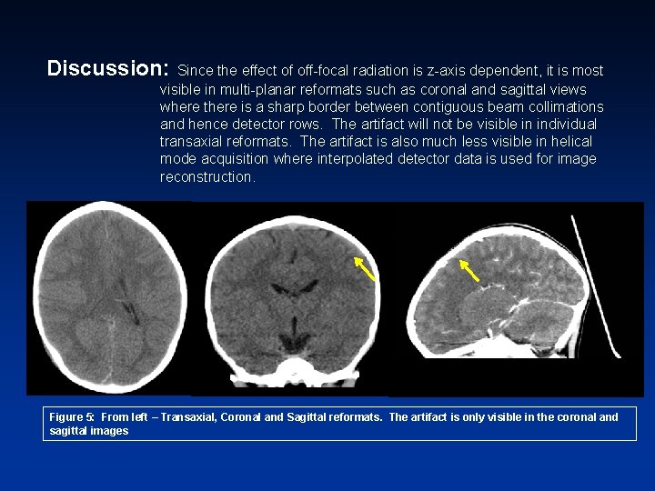 Discussion: Since the effect of off-focal radiation is z-axis dependent, it is most visible