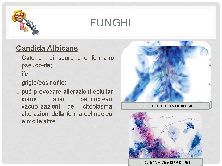 FUNGHI Candida Albicans o Catene di spore che formano pseudo-ife; o grigio/eosinofilo; o può