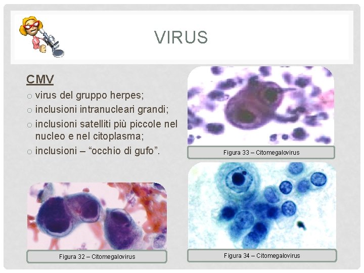 VIRUS CMV o virus del gruppo herpes; o inclusioni intranucleari grandi; o inclusioni satelliti