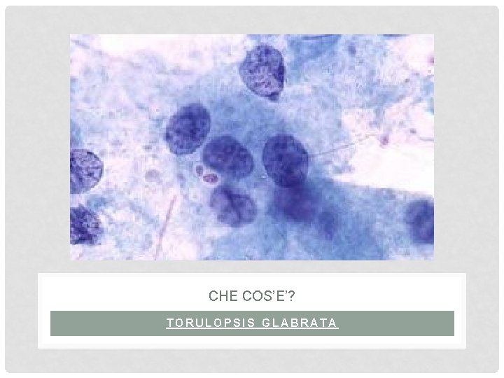 CHE COS’E’? TORULOPSIS GLABRATA 