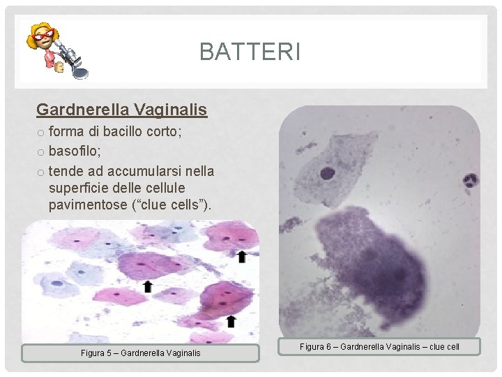 BATTERI Gardnerella Vaginalis o forma di bacillo corto; o basofilo; o tende ad accumularsi