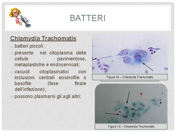 BATTERI Chlamydia Trachomatis o batteri piccoli ; o presente nel citoplasma delle cellule pavimentose,