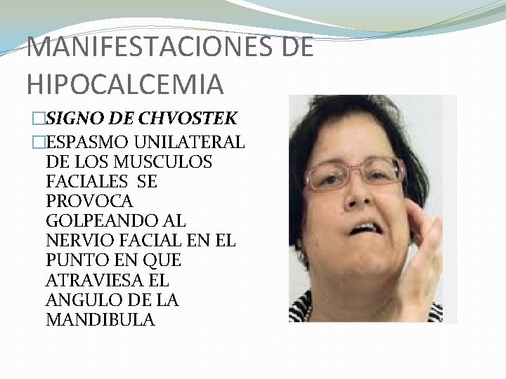 MANIFESTACIONES DE HIPOCALCEMIA �SIGNO DE CHVOSTEK �ESPASMO UNILATERAL DE LOS MUSCULOS FACIALES SE PROVOCA