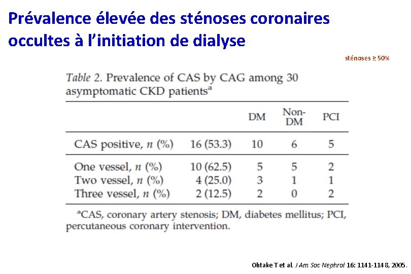 Prévalence élevée des sténoses coronaires occultes à l’initiation de dialyse sténoses ≥ 50% Ohtake