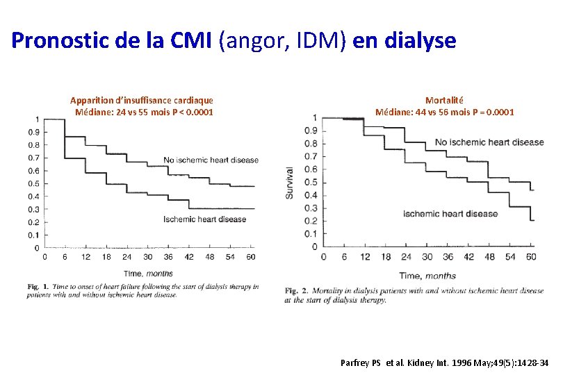 Pronostic de la CMI (angor, IDM) en dialyse Apparition d’insuffisance cardiaque Médiane: 24 vs