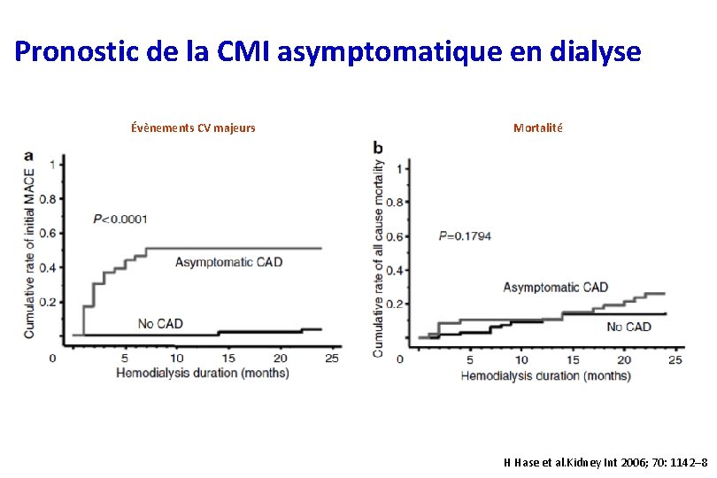 Pronostic de la CMI asymptomatique en dialyse Évènements CV majeurs Mortalité H Hase et