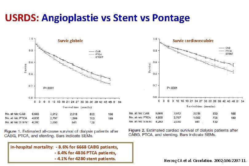 USRDS: Angioplastie vs Stent vs Pontage Survie globale in-hospital mortality: - 8. 6% for