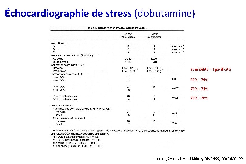 Échocardiographie de stress (dobutamine) Sensibilité – Spécificité 52% - 74% 75% - 71% 75%