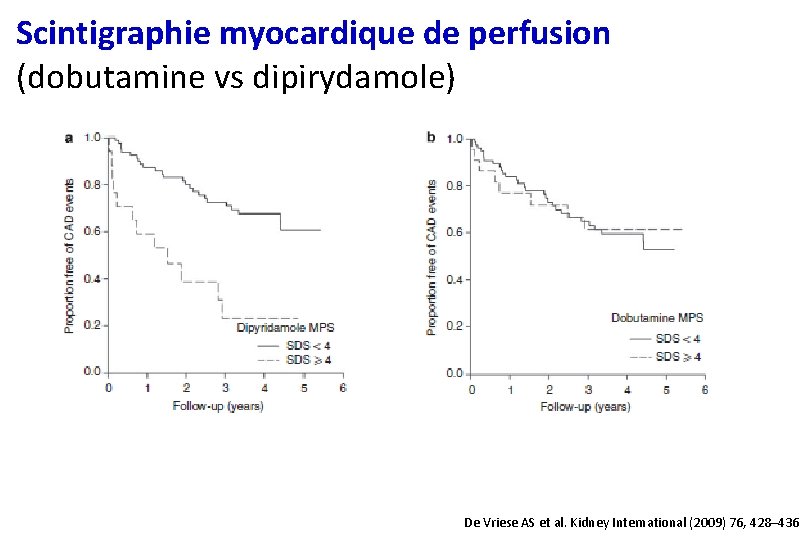 Scintigraphie myocardique de perfusion (dobutamine vs dipirydamole) De Vriese AS et al. Kidney International