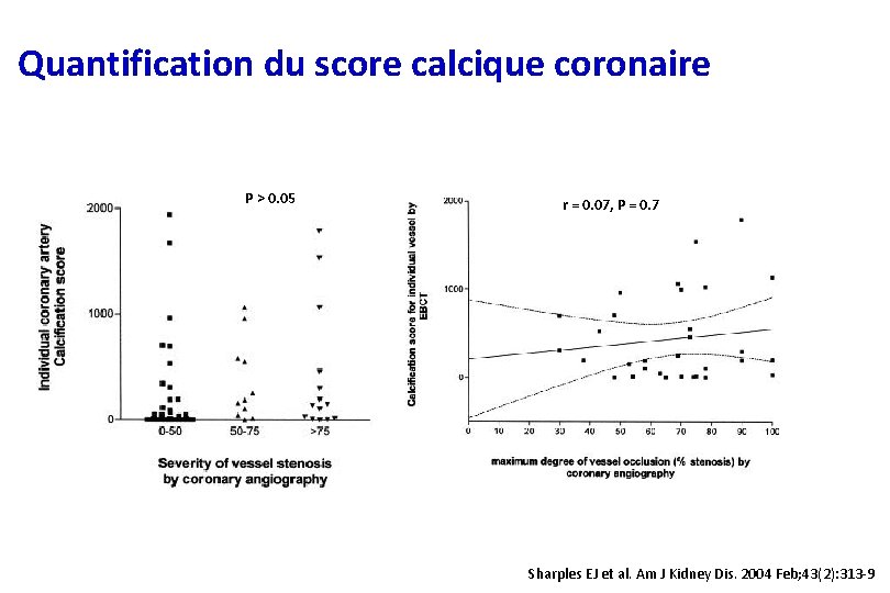 Quantification du score calcique coronaire P > 0. 05 r = 0. 07, P