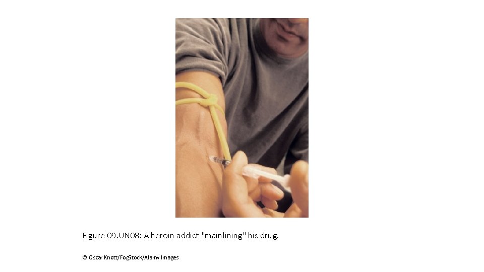 Figure 09. UN 08: A heroin addict "mainlining" his drug. © Oscar Knott/Fog. Stock/Alamy