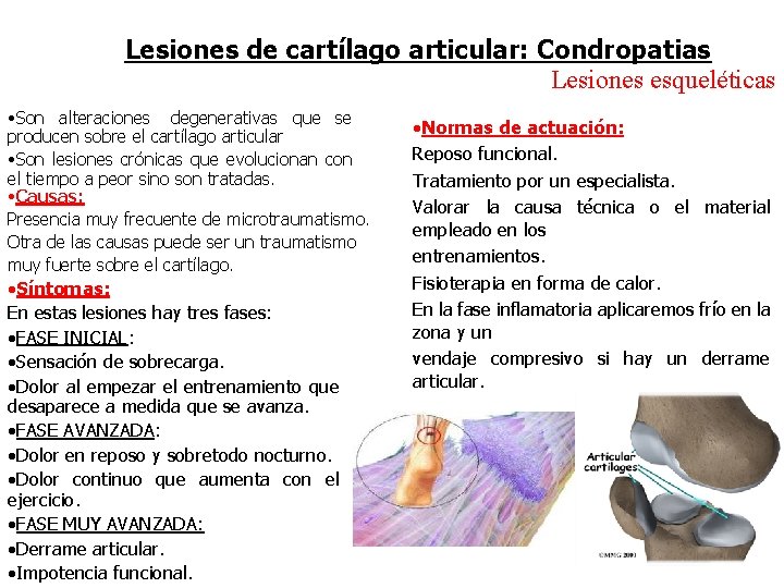 Lesiones de cartílago articular: Condropatias Lesiones esqueléticas • Son alteraciones degenerativas que se producen