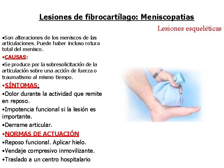 Lesiones de fibrocartílago: Meniscopatias Lesiones esqueléticas • Son alteraciones de los meniscos de las