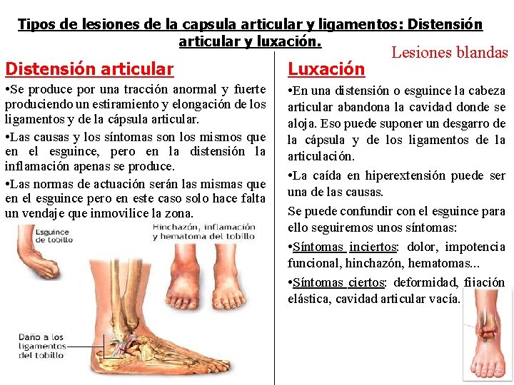 Tipos de lesiones de la capsula articular y ligamentos: Distensión articular y luxación. Lesiones