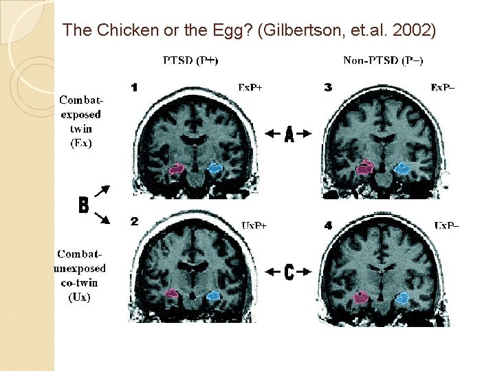 The Chicken or the Egg? (Gilbertson, et. al. 2002) 