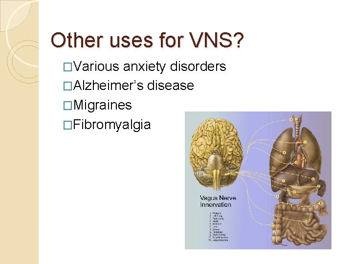 Other uses for VNS? �Various anxiety disorders �Alzheimer’s disease �Migraines �Fibromyalgia 