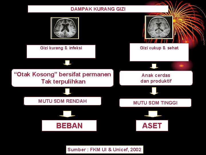 DAMPAK KURANG GIZI Gizi kurang & infeksi Gizi cukup & sehat “Otak Kosong” bersifat