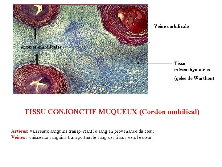 Veine ombilicale Artères ombilicales Tissu mésenchymateux (gelée de Warthon) TISSU CONJONCTIF MUQUEUX (Cordon ombilical)