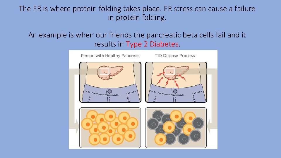 The ER is where protein folding takes place. ER stress can cause a failure