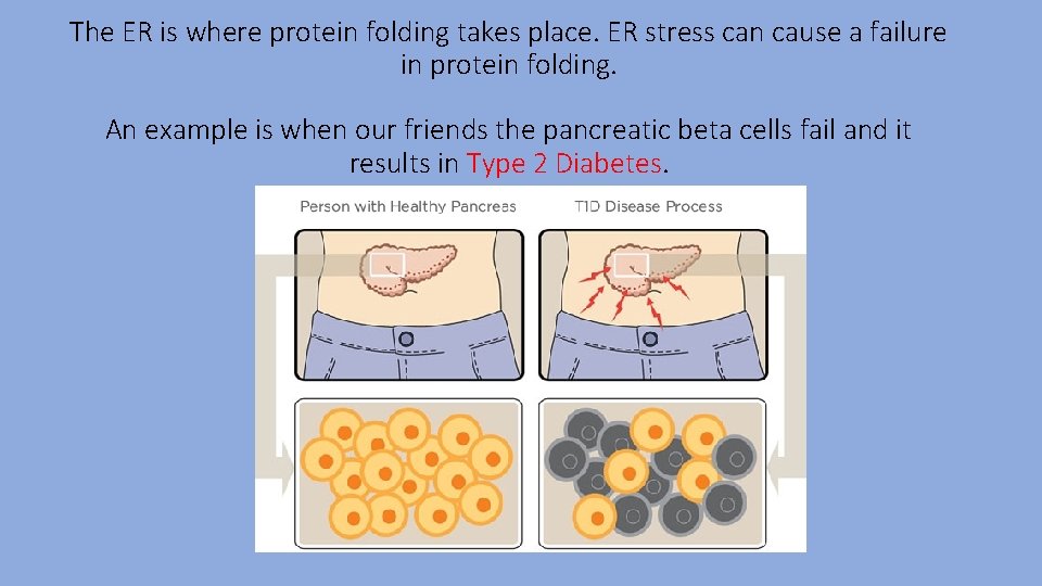 The ER is where protein folding takes place. ER stress can cause a failure