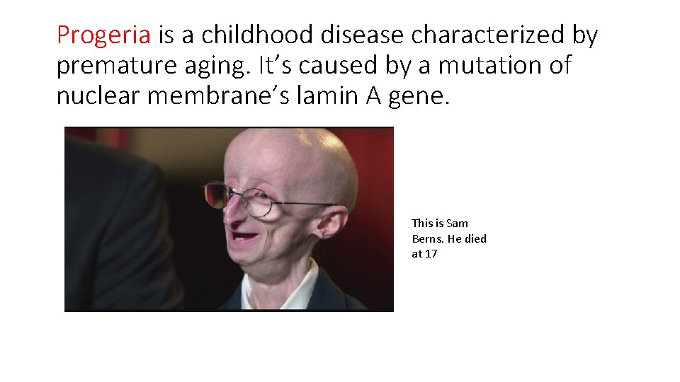 Progeria is a childhood disease characterized by premature aging. It’s caused by a mutation