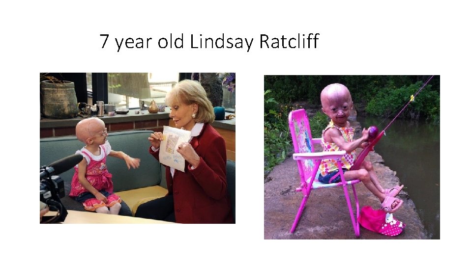 7 year old Lindsay Ratcliff 