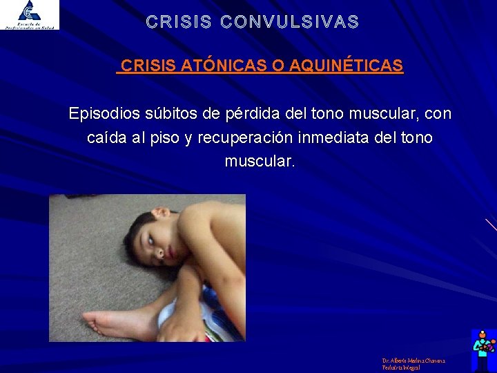 CRISIS ATÓNICAS O AQUINÉTICAS Episodios súbitos de pérdida del tono muscular, con caída al