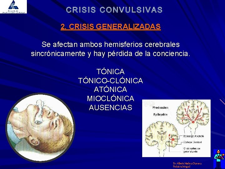 2. CRISIS GENERALIZADAS Se afectan ambos hemisferios cerebrales sincrónicamente y hay pérdida de la