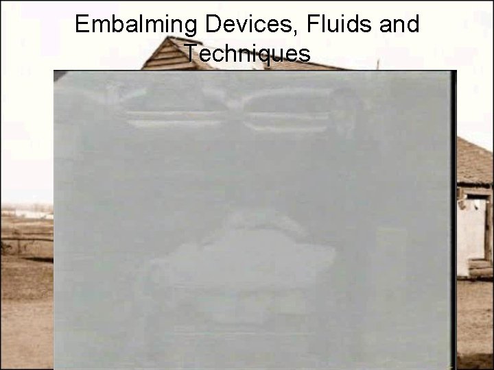 Embalming Devices, Fluids and Techniques 