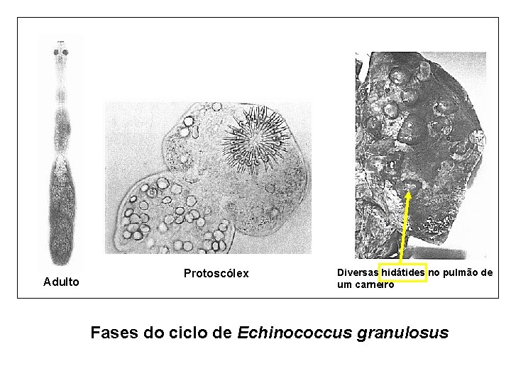 Adulto Protoscólex Diversas hidátides no pulmão de um carneiro Fases do ciclo de Echinococcus