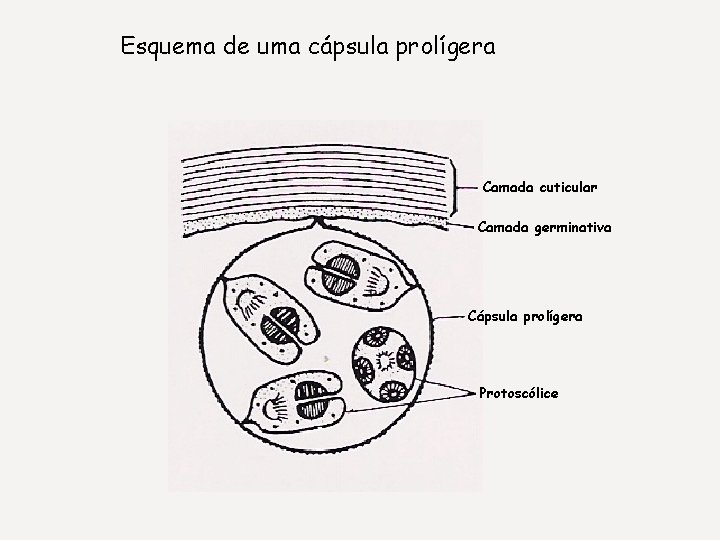 Esquema de uma cápsula prolígera Camada cuticular Camada germinativa Cápsula prolígera Protoscólice 