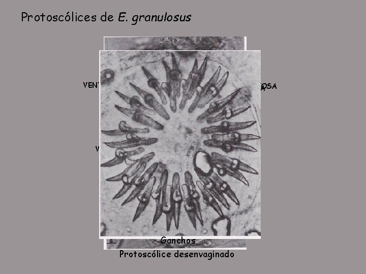 Protoscólices de E. granulosus VENTOSA VENTOSA Corpúsculo calcáreo Protoscólice invaginado Ganchos Protoscólice desenvaginado 