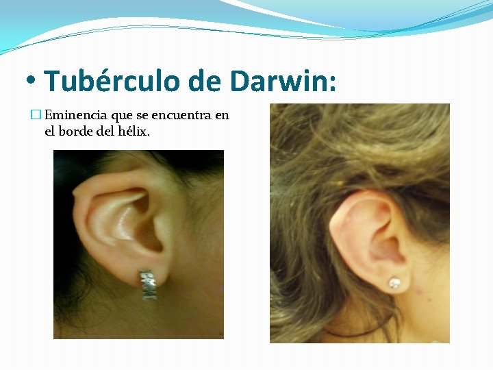  • Tubérculo de Darwin: � Eminencia que se encuentra en el borde del