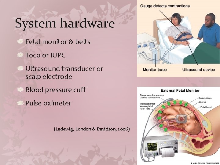 System hardware Fetal monitor & belts Toco or IUPC Ultrasound transducer or scalp electrode