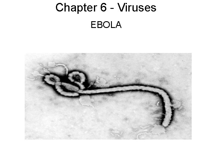 Chapter 6 - Viruses EBOLA 
