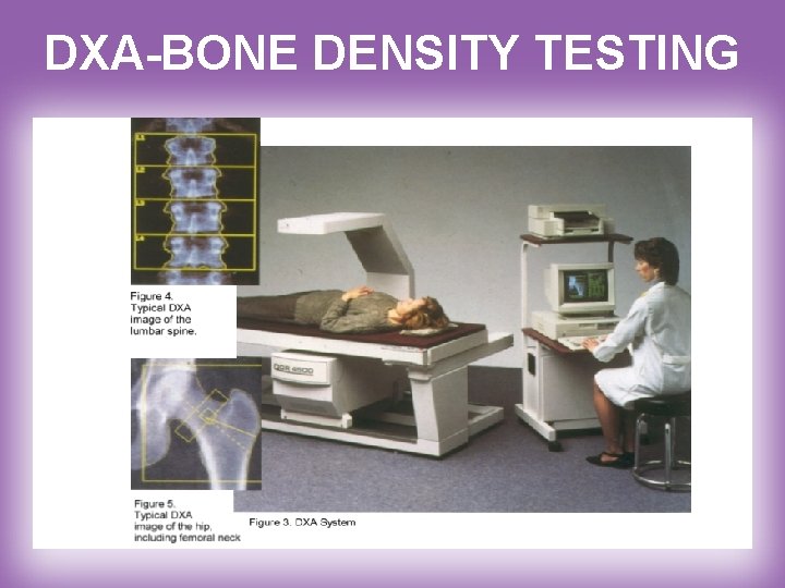 DXA-BONE DENSITY TESTING 