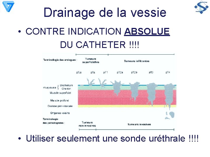 Drainage de la vessie • CONTRE INDICATION ABSOLUE DU CATHETER !!!! • Utiliser seulement