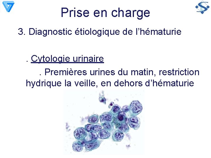 Prise en charge 3. Diagnostic étiologique de l’hématurie. Cytologie urinaire. Premières urines du matin,