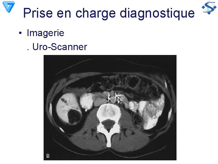 Prise en charge diagnostique • Imagerie. Uro-Scanner 