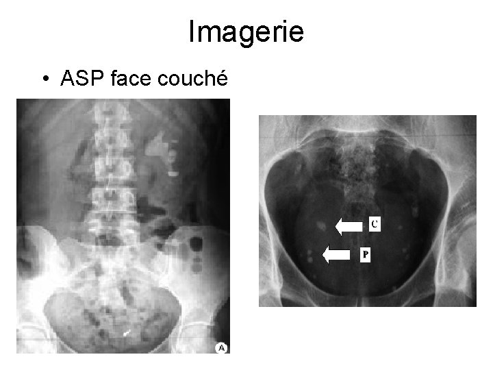 Imagerie • ASP face couché 