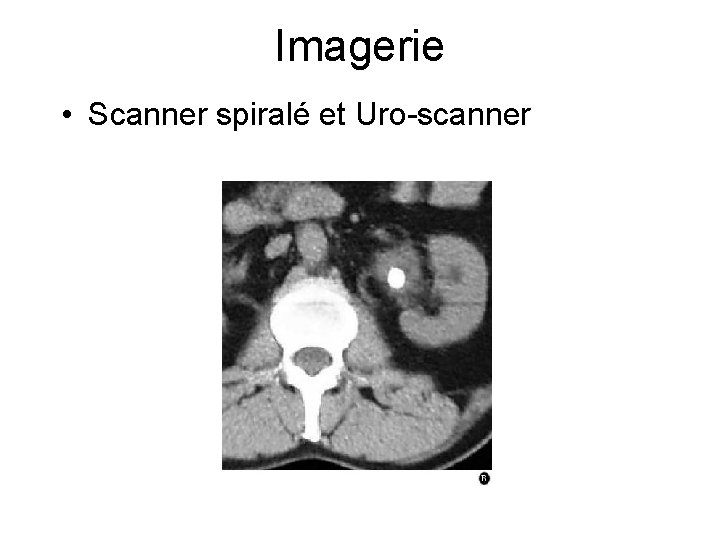 Imagerie • Scanner spiralé et Uro-scanner 