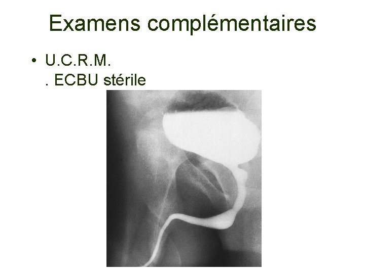 Examens complémentaires • U. C. R. M. . ECBU stérile 