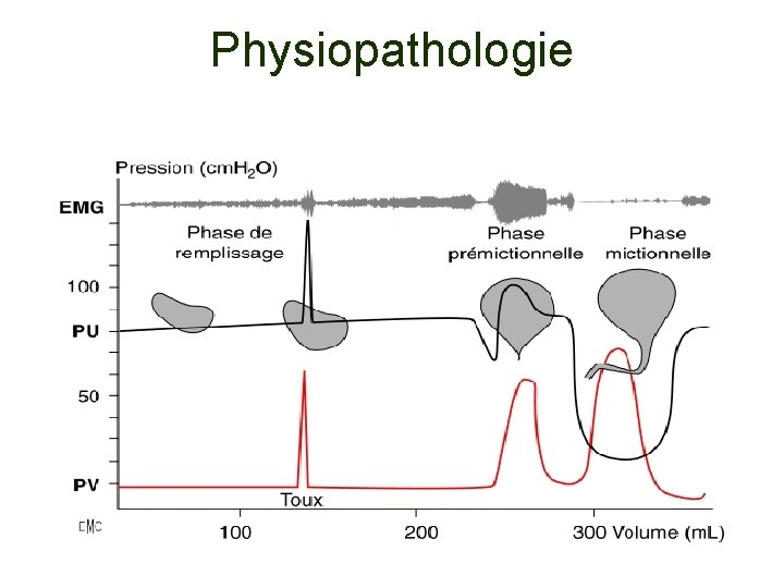 Physiopathologie 