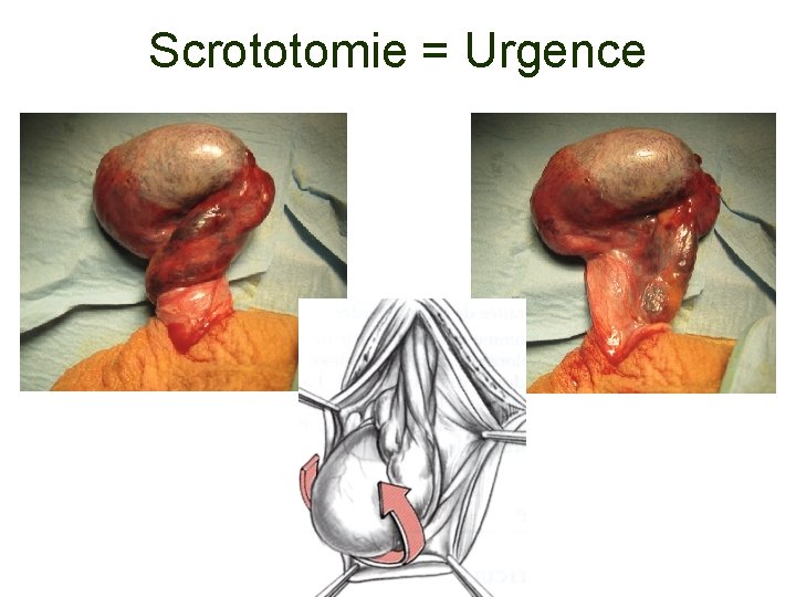 Scrototomie = Urgence 