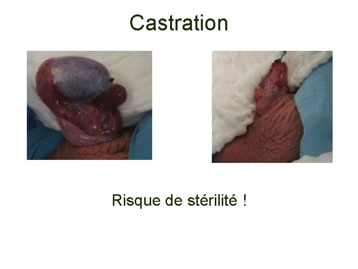 Castration Risque de stérilité ! 