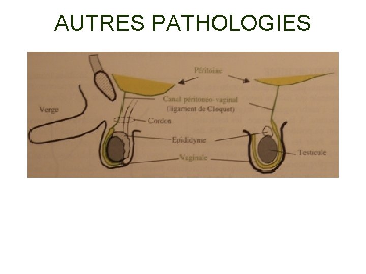 AUTRES PATHOLOGIES 
